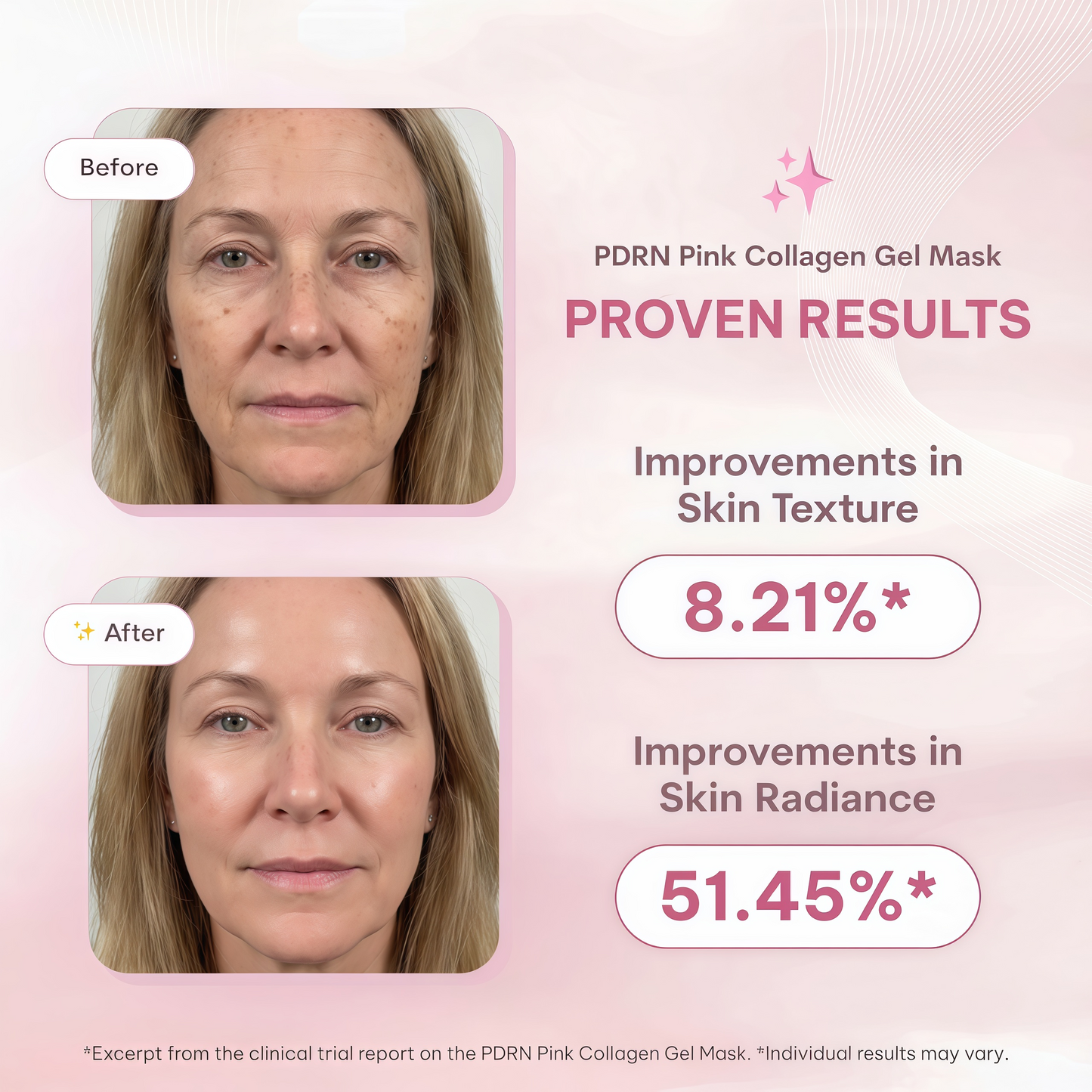 Quasi Salmon PDRN Collagen Mask – Korean Skin care Gel Face Mask for Hydration, Firming & Smoothing Skincare, Collagen Boost & Pore Care – 4 Masks, Non-Irritating, Natural Ingredients